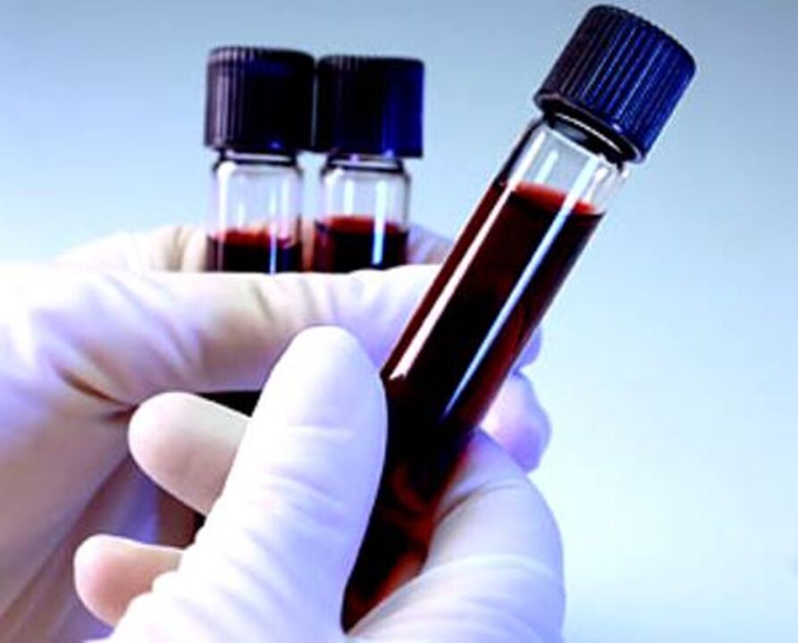 tubes of blood plasma for plasma skin rejuvenation