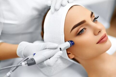 Facial skin rejuvenation with a laser device. 