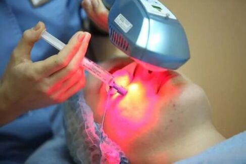 Laser biorevitalization of facial skin. 