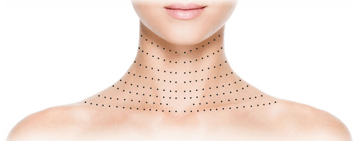 neck and cleavage how to rejuvenate